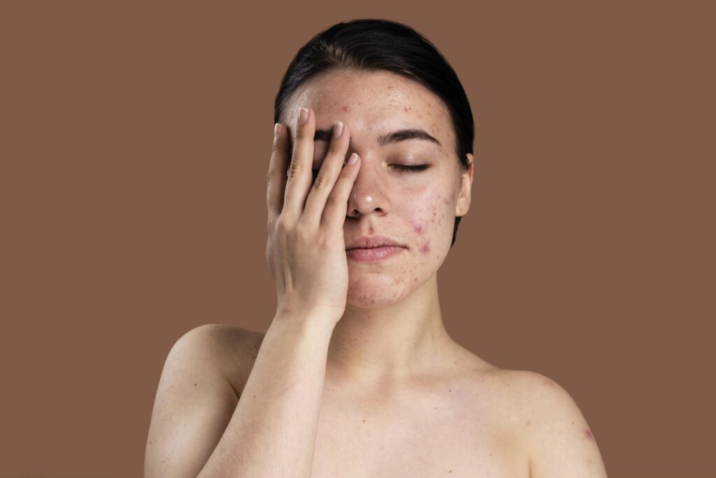 Laser hair removal in jaipur